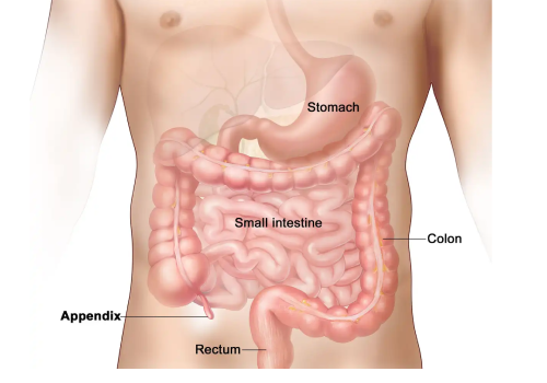 Appendix Treatment in Ahmedabad