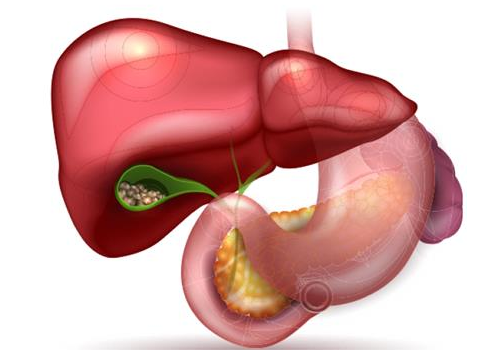 Gall Stones Treatment In Ahmedabad