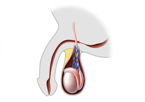 Urethral Stricture Treatment In Ahmedabad
